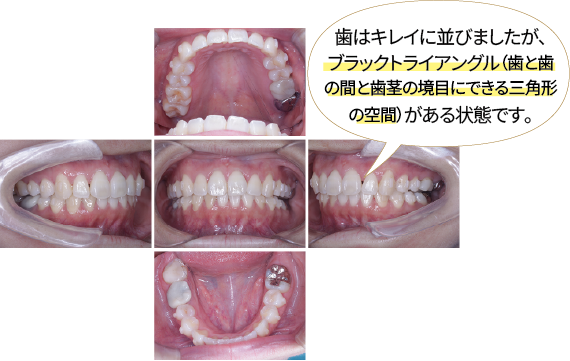 during
