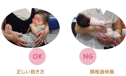 正しい抱き方と誤った抱き方の比較イメージ