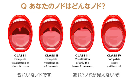 Q あなたのノドはどんなノド？