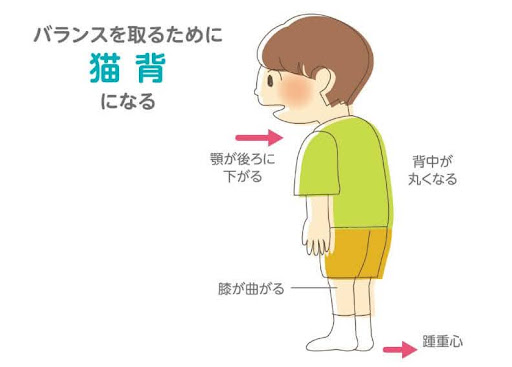 バランスを取るために 猫背になる