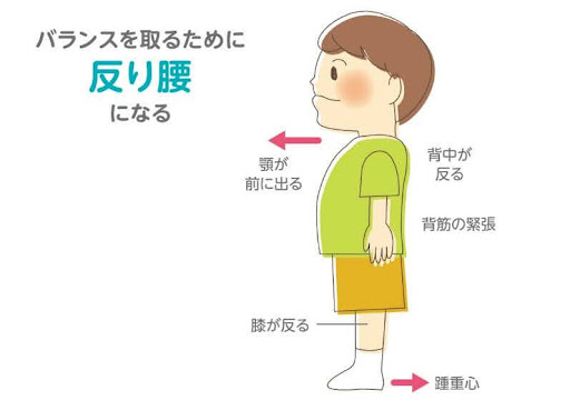 バランスを取るために 反り腰